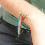 קרס דיג נשלף מזרועו של ילד במרפאת "כללית" בחיספין